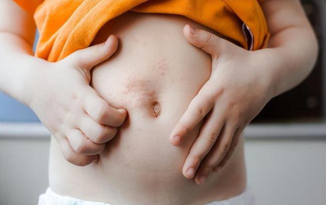 人不会无故带状疱疹！医生提醒：带状疱疹的人，多半有这些习惯